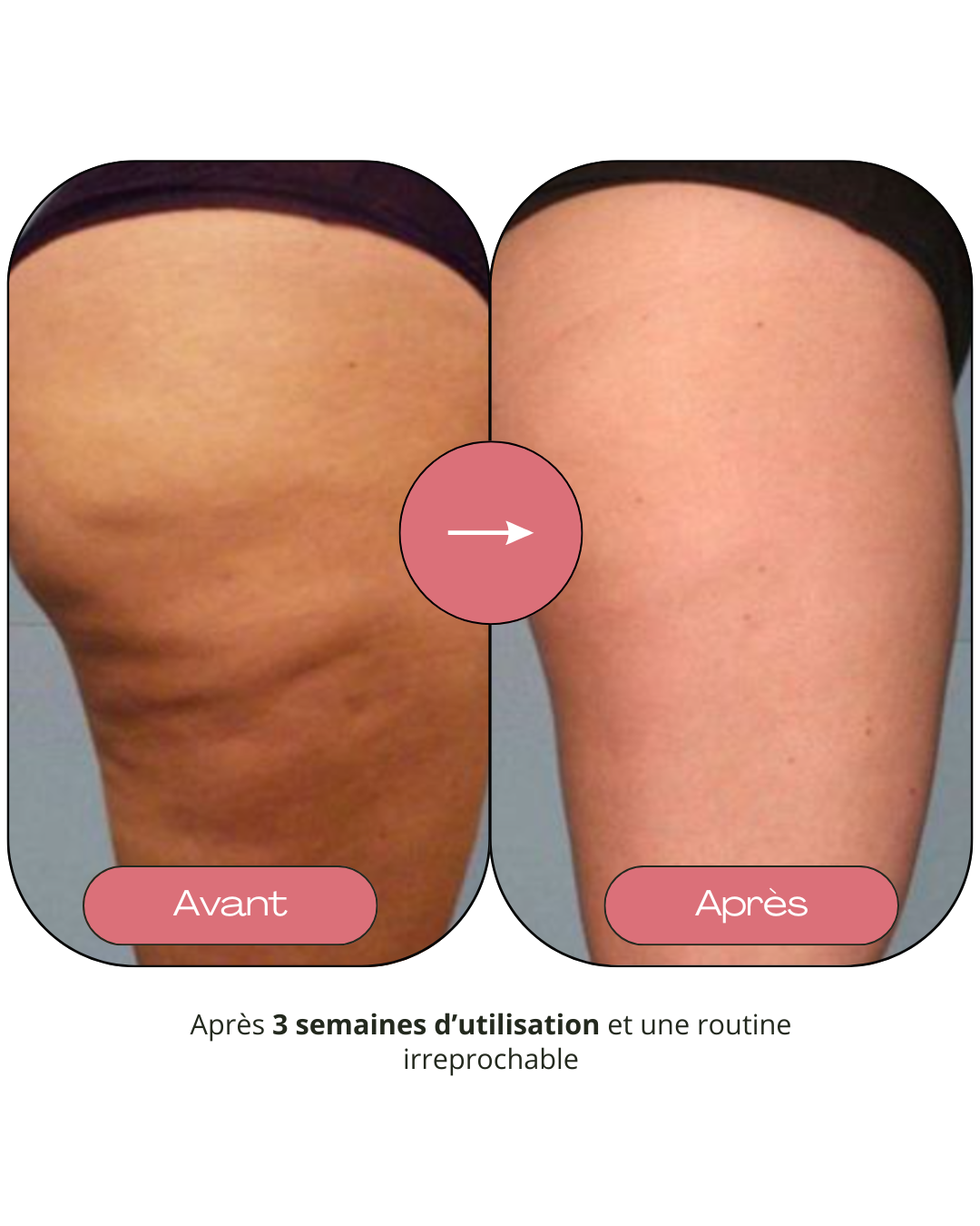 Guasha pour le corps